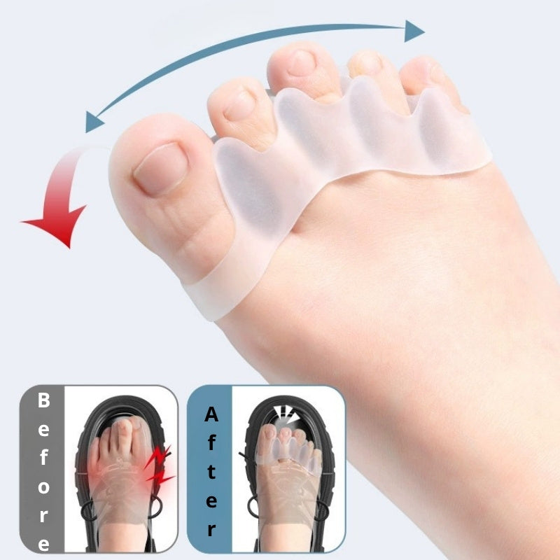 Toe Separator VIP